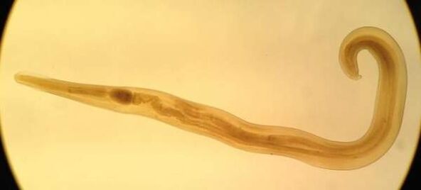 Pinworm