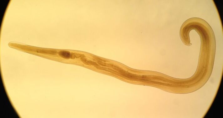 Pinworms são um tipo comum de parasita redondo que causa enterobíase.
