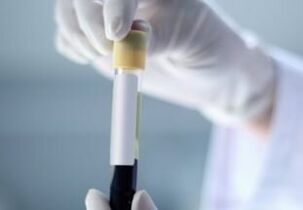 exame de sangue para detectar parasitas no corpo